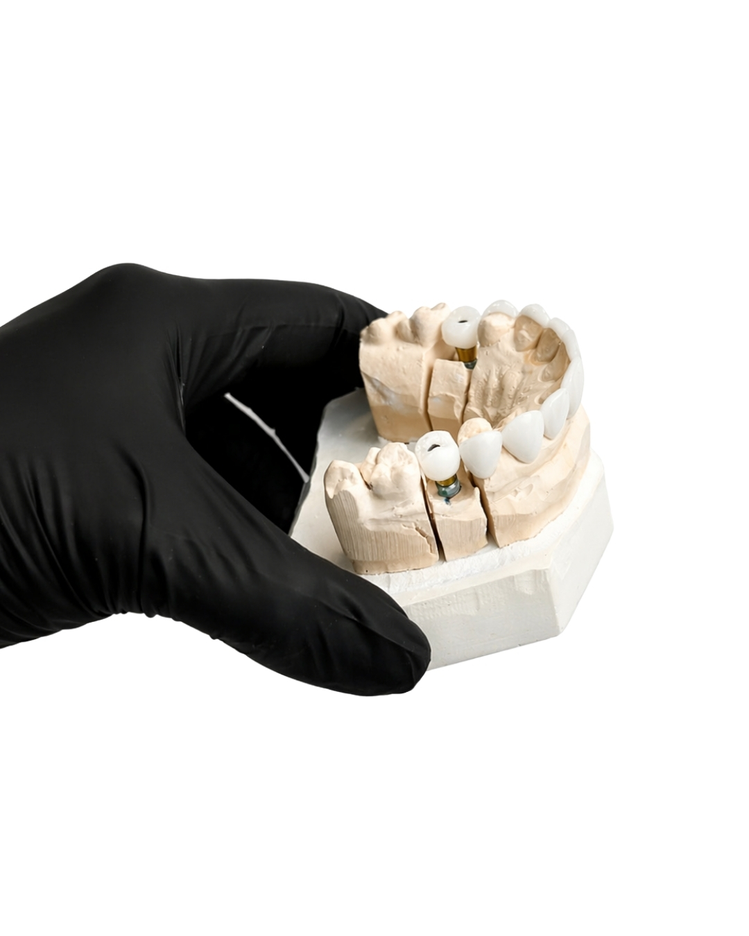 implant